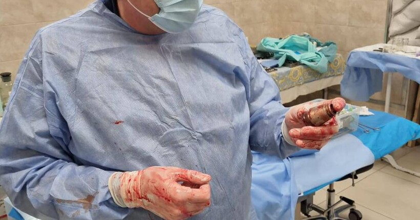 Операція під наглядом саперів: хірурги дістали з тіла українського захисника нездетонований боєприпас