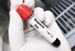 Метапневмовірус: у ЦГЗ назвали симптоми та шляхи зараження