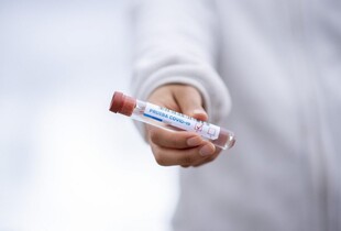 ВООЗ опублікувала свіжий висновок про походження COVID-19 після трьох років досліджень