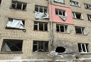 Атаки рф на Харківщину: поранено двох дітей