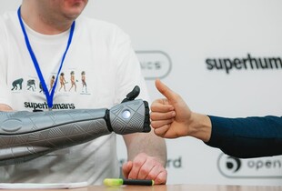 Свириденко анонсувала запуск грантів на біонічні протези та відповіла, коли відбудують 