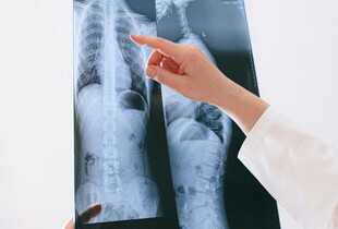 Фастфуд і рак легенів: що показало нове дослідження про харчування