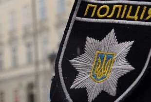 На Київщині собака напала на 9-річного хлопчика: поліцейські проводять досудове розслідування