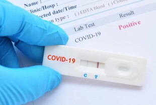 Нові штами COVID-19 в Україні: в ЦГЗ озвучили кількість випадків Stratus і Nimbus