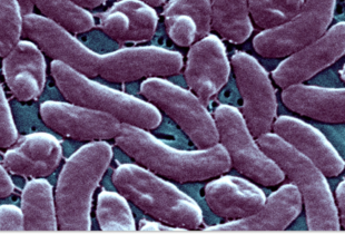 У США зросла кількість випадків зараження бактерією Vibrio vulnificus