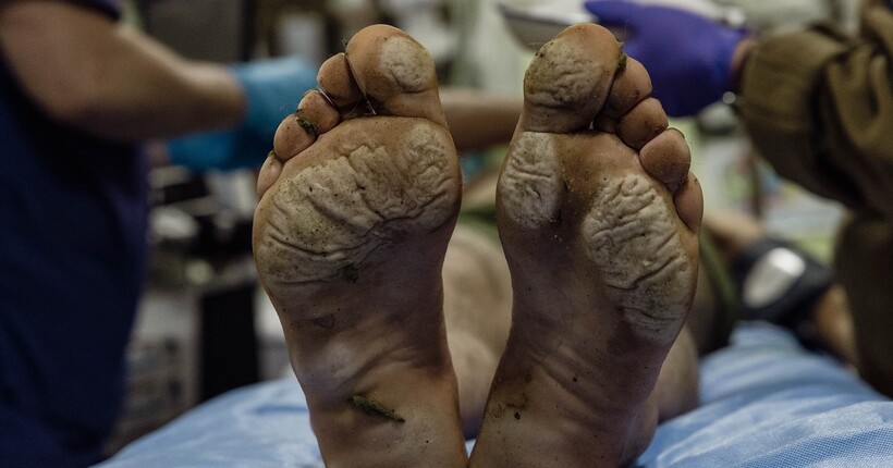 Медеваки в Покровськ не заїжджають: бойовий медик про евакуацію поранених з міста