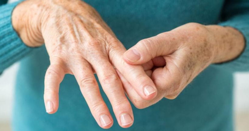 Як полегшити біль при артриті: дієві домашні способи 