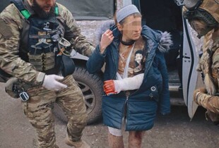 У Костянтинцівці росіяни атакували жінку FPV-дроном