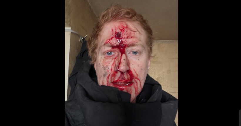 Волонтер Денис Христов потрапив під обстріл на Куп'янщині