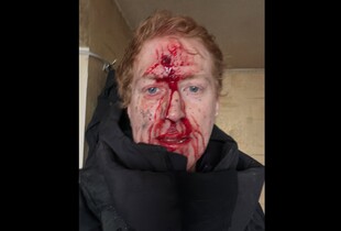 Волонтер Денис Христов потрапив під обстріл на Куп'янщині