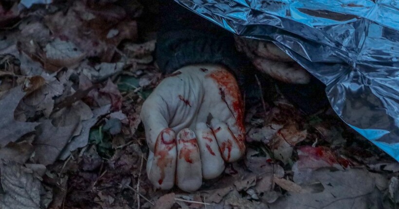 Атака 24 березня: стали відомі обставини загибелі людини у Вінниці