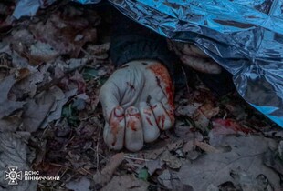 Атака 24 березня: стали відомі обставини загибелі людини у Вінниці