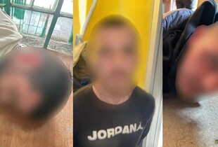 Правоохоронці затримали трьох підозрюваних у нападі на суддю в Дніпрі