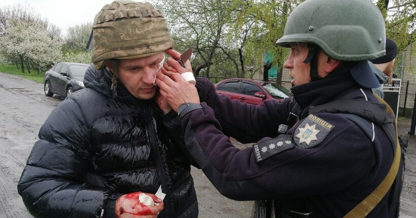 На Дніпропетровщині чоловік кинув гранату у поліцейських: п'ятеро поранених