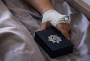 Після російського удару на Полтавщині 15 рятувальників залишаються у лікарнях - Клименко
