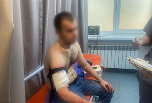 У Запоріжжі чоловік поранив ножем трьох поліцейських: нападника застрелили