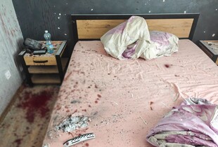 На Рівненщині через вибух гранати у будинку отримали поранення 22-річний хлопець та його 23-річна дівчина