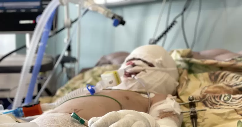 Стерти сліди війни: як українські дерматологи надають допомогу постраждалим від обстрілів