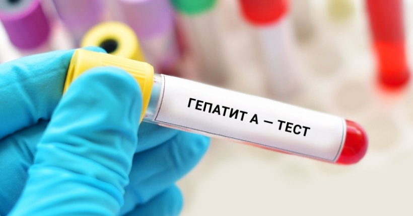  На Київщині зафіксували випадок захворювання на гепатит А